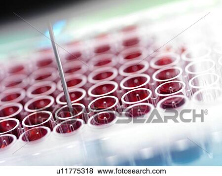 Stock Photo - Automated blood screening. Fotosearch
