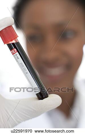 Stock Image - Blood sample. Fotosearch