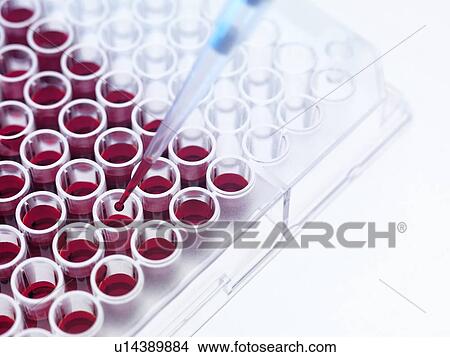 Picture - Blood samples. Fotosearch