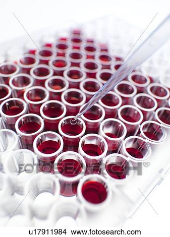 Picture - Blood samples. Fotosearch