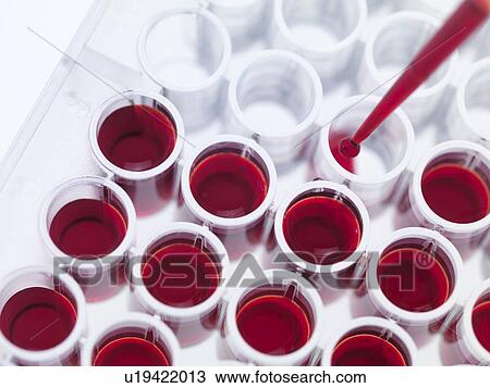Stock Image - Blood samples. Fotosearch
