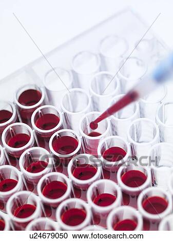 Blood samples View Large Photo Image Stock Image - Blood samples. Fotosearch