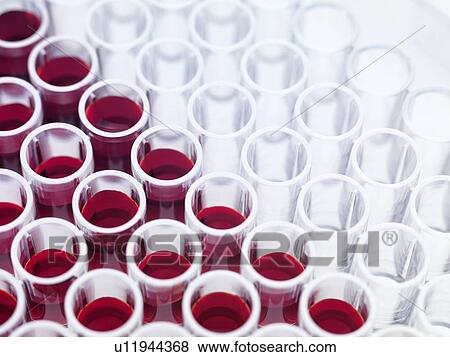 Blood samples View Large Photo Image Stock Photo - Blood samples. Fotosearch