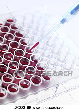 Stock Photo - Blood samples. Fotosearch