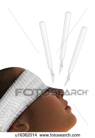 Cosmetic surgery, conceptual artwork View Large Photo Image Picture - Cosmetic surgery, conceptual artwork. Fotosearch