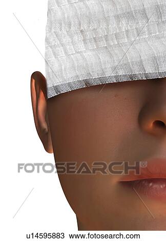 Stock Image - Cosmetic surgery, conceptual artwork. Fotosearch