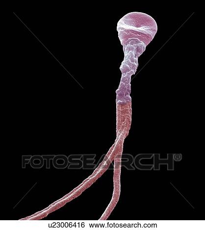 Deformed sperm cell, SEM View Large Photo Image Stock Photograph - Deformed sperm cell, SEM. Fotosearch