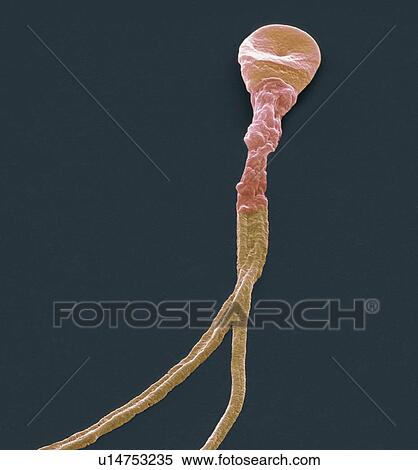 Deformed sperm cell, SEM View Large Photo Image Stock Photography - Deformed sperm cell, SEM. Fotosearch