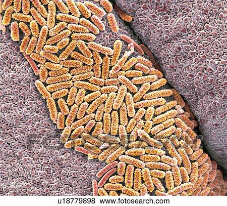 Stock Photo - E coli bacteria, SEM. Fotosearch