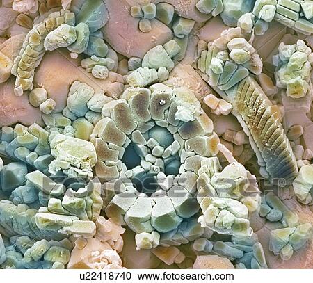 Stock Image - Fossil debris in chalk, SEM. Fotosearch