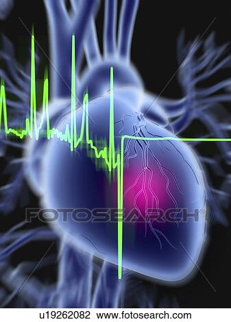 Heart attack and ECG trace View Large Photo Image Stock Image - Heart attack and ECG trace. Fotosearch
