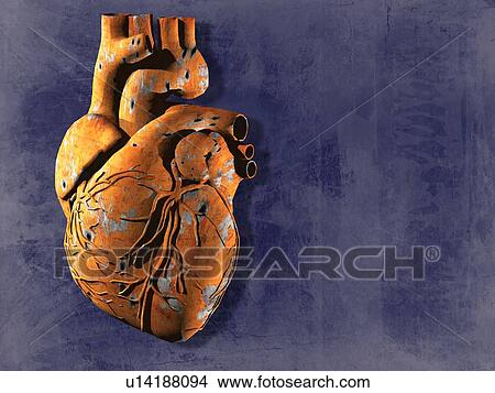 Picture - Heart disease, conceptual artwork. Fotosearch