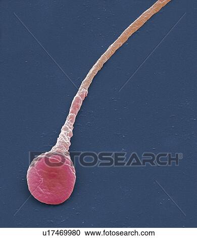 Stock Image - Human sperm cell, SEM. Fotosearch