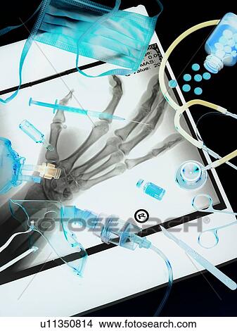 Picture - Medical treatment, conceptual image. Fotosearch