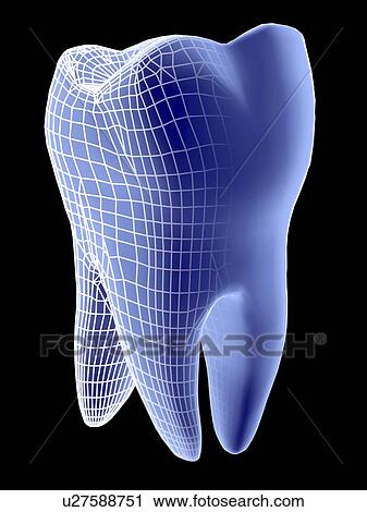 Molar tooth View Large Photo Image Stock Image - Molar tooth. Fotosearch
