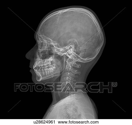 Normal child's head, X-ray View Large Photo Image Stock Image - Normal child's head, X-ray. Fotosearch