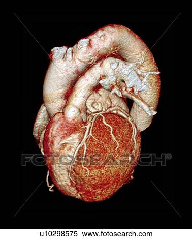 Normal heart, 3D CT scan View Large Photo Image Stock Photography - Normal heart, 3D CT scan. Fotosearch