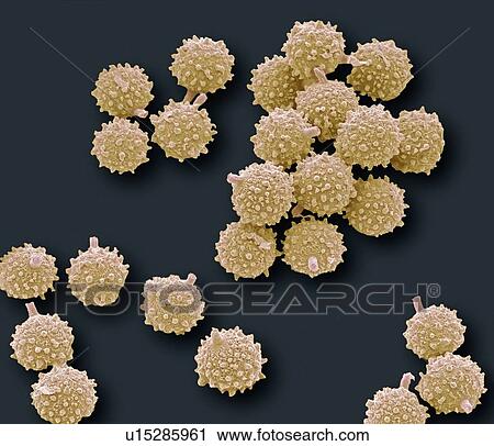Stock Image - Puffball fungus spores, SEM. Fotosearch
