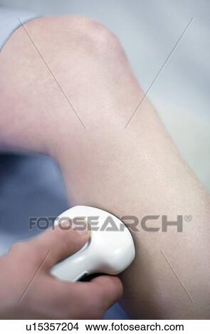 Picture - Ultrasound scan. Fotosearch