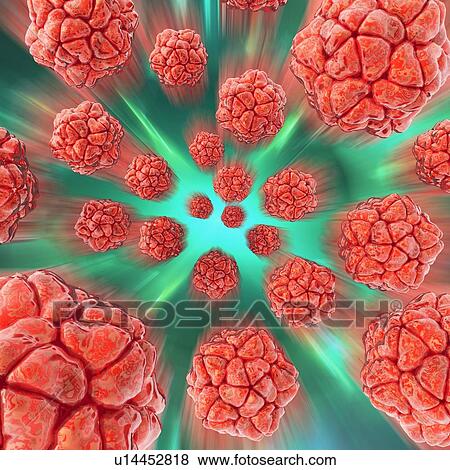 Viral infection, conceptual artwork View Large Photo Image Stock Photo - Viral infection, conceptual artwork. Fotosearch