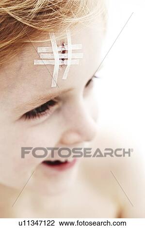 Young boy with head wound View Large Photo Image Stock Image - Young boy with head wound. Fotosearch