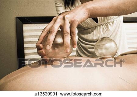 Nurse vacuum cupping patient View Large Photo Image Stock Image - Nurse vacuum cupping patient. Fotosearch