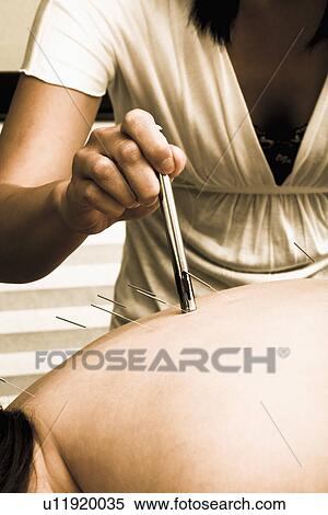 Stock Photography - Nurse with acupuncture patient. Fotosearch