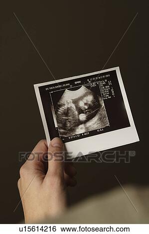Woman holding ultrasonograph photo of baby View Large Photo Image Stock Photograph - Woman holding ultrasonograph photo of baby. Fotosearch