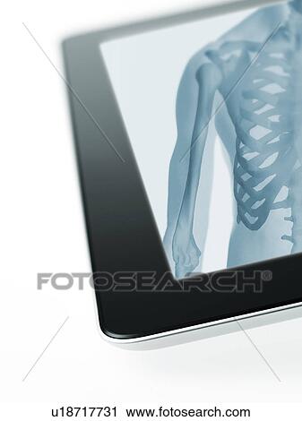 Studio shot of digital tablet with x-ray of human chest View Large Photo Image Stock Image - Studio shot of digital tablet with x-ray of human chest. Fotosearch