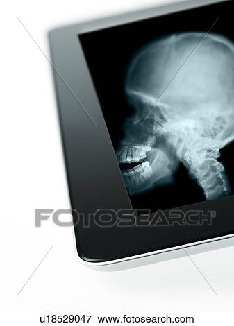 Studio shot of digital tablet with x-ray of human foot View Large Photo Image Stock Photo - Studio shot of digital tablet with x-ray of human foot. Fotosearch