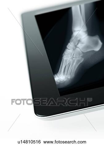 Studio shot of digital tablet with x-ray of human foot View Large Photo Image Stock Photograph - Studio shot of digital tablet with x-ray of human foot. Fotosearch