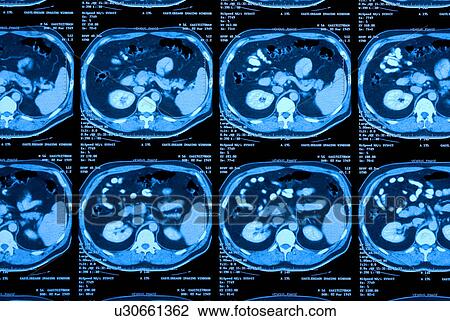 Brain scans View Large Photo Image Stock Image - Brain scans. Fotosearch