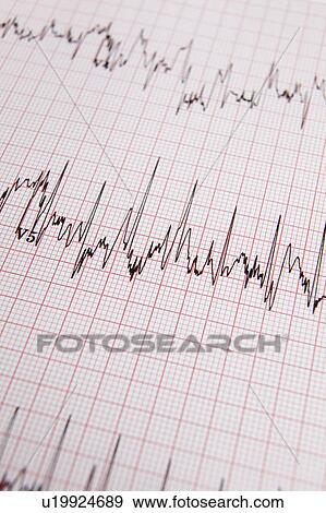 Stock Photo - ECG print out. Fotosearch
