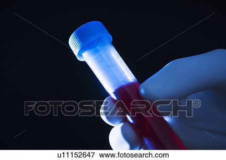 Stock Photo - Studio shot of hand holding vial with blood. Fotosearch