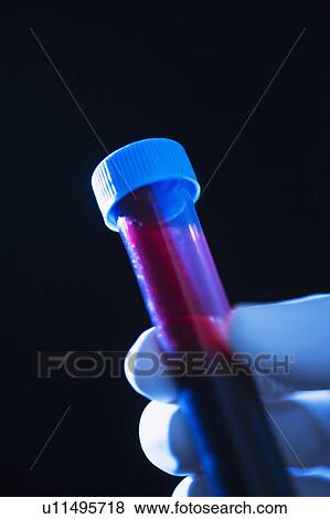 Stock Photo - Studio shot of hand holding vial with blood. Fotosearch