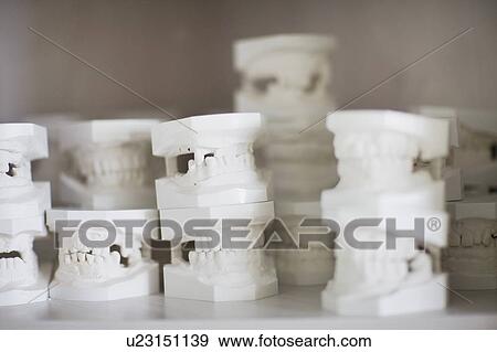 Plaster models of teeth View Large Photo Image Stock Photo - Plaster models of teeth . Fotosearch