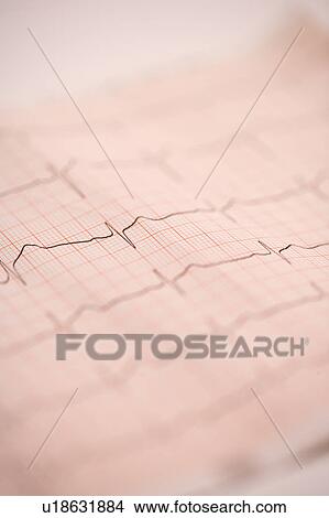 EKG View Large Photo Image Picture - EKG. Fotosearch
