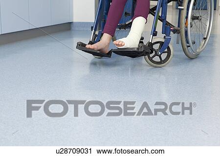 Foot in plaster, feet in wheelchair View Large Photo Image Stock Image - Foot in plaster, feet in wheelchair. Fotosearch