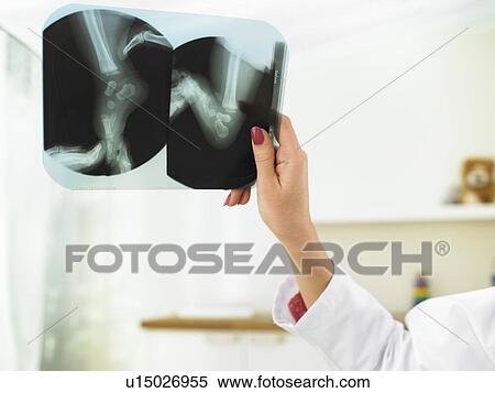 Stock Photography - Hand holding X-ray. Fotosearch