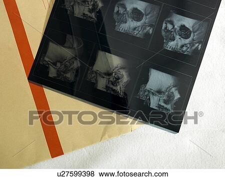 X-ray and envelope View Large Photo Image Stock Photo - X-ray and envelope. Fotosearch