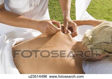 Stock Photograph - Man having acupuncture outdoors. Fotosearch
