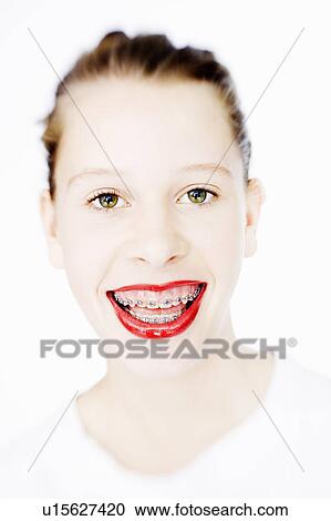 Stock Image - Woman in braces wearing red lipstick. Fotosearch