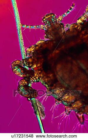 Close up of crab louse on hair View Large Photo Image Stock Photo - Close up of crab louse on hair. Fotosearch