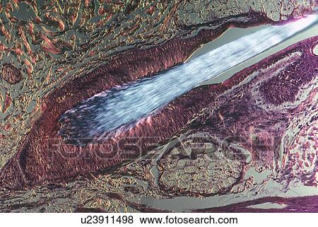 Stock Photo - Close up of hair growing in follicle. Fotosearch