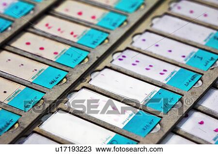 Stock Image - Close up of histopatology slices. Fotosearch