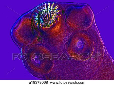 Stock Photo - Head of pork tapeworm. Fotosearch