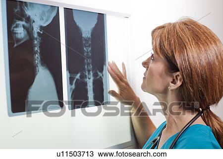 Stock Image - Doctor looking at x-ray. Fotosearch