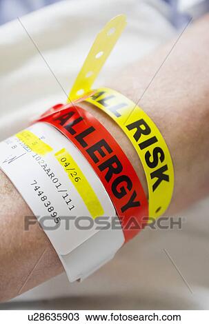 Stock Image - Close up of patient's hand with information wrist bands. Fotosearch