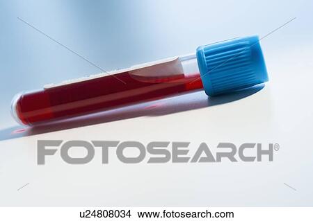 Picture - Studio shot of blood sample. Fotosearch