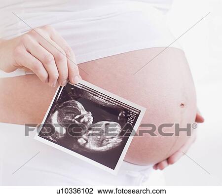 Stock Image - Pregnant woman with ultrasonography scan. Fotosearch